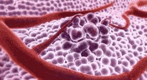 如果水蛭吸到了人物会怎么样,如果水蛭进了身体吃什么药