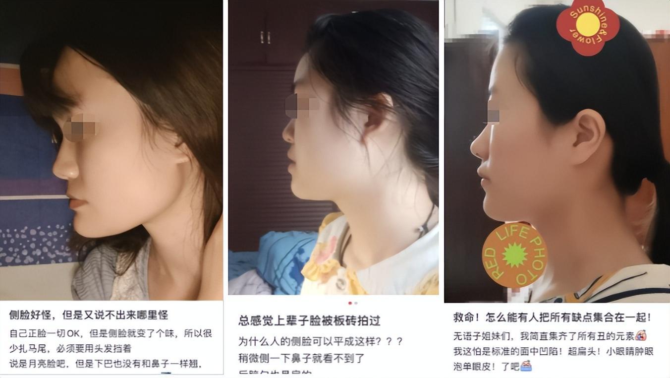 为什么大部分亚洲人都是扁头,正脸好看但侧脸丑到爆怎样办