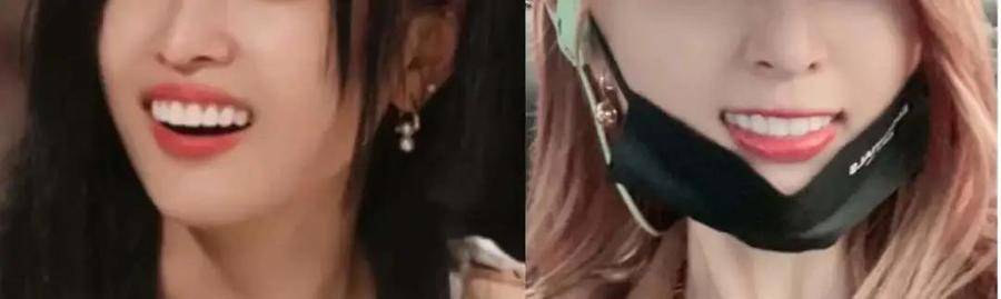 国民初恋毁容了,国民初恋盛世美颜