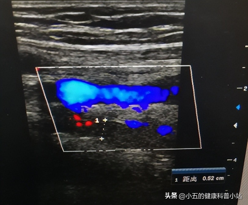 白天没事晚上腿难受睡不着觉,白天没事晚上腿酸痛是怎么回事