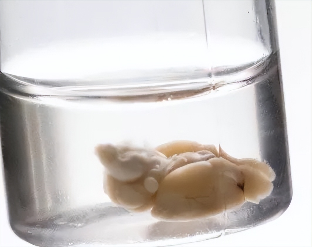 电击大脑能提高思考速度吗,电击大脑快速入眠