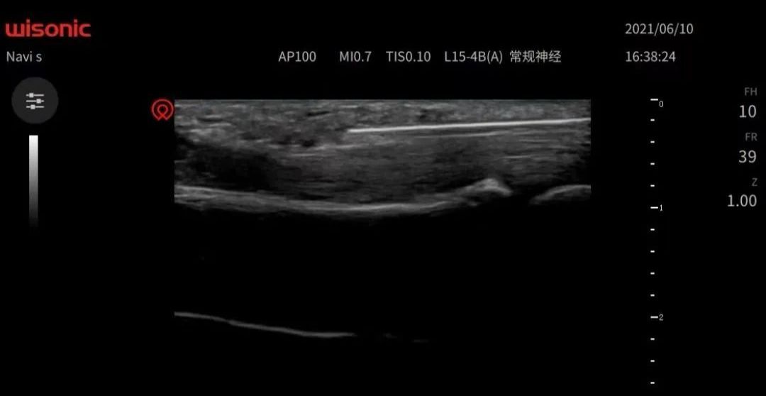 山西煤炭中心医院超声科主任,山西省煤炭中心医院在哪