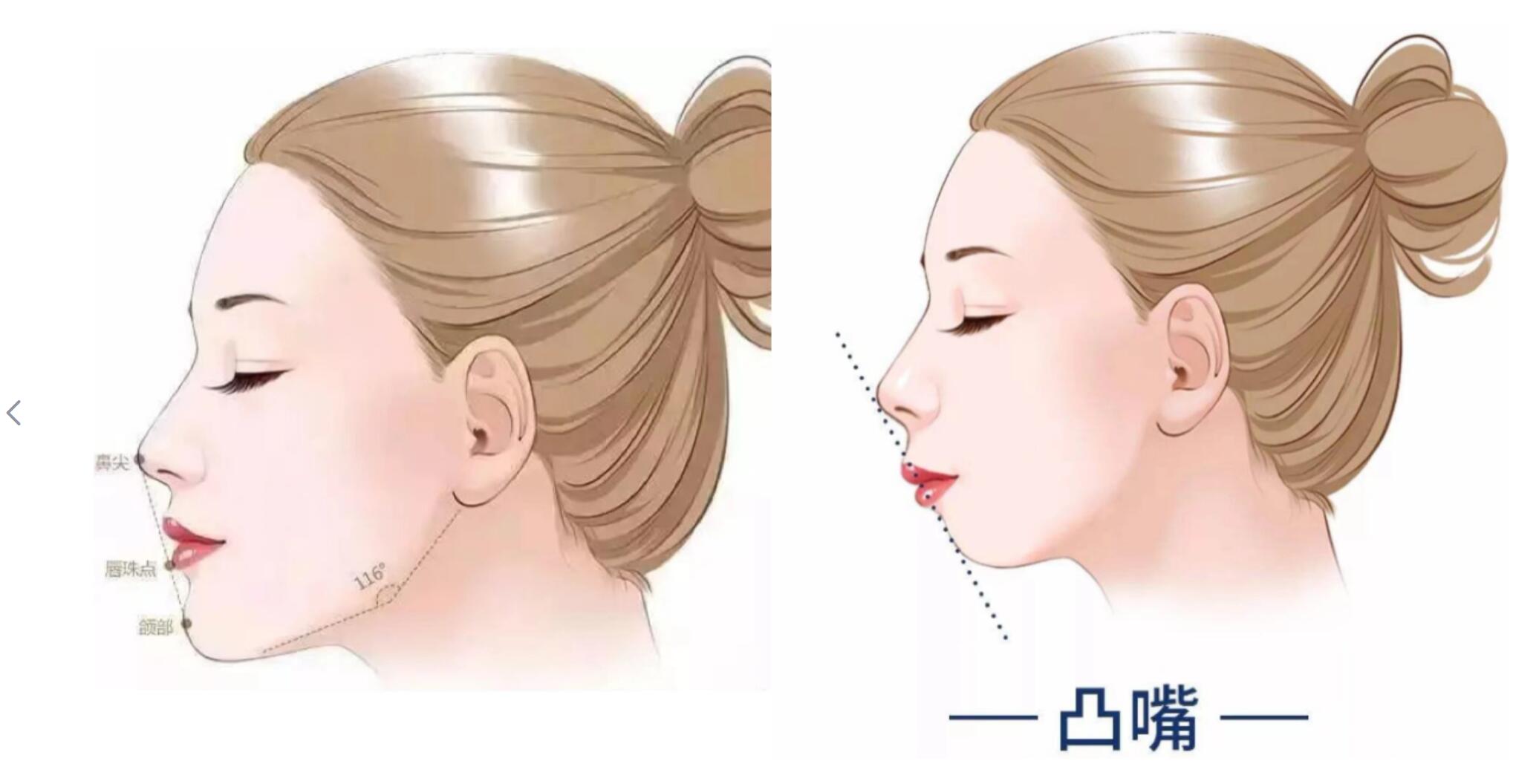 同样都是“凸嘴”，为什么有人风情万种，有人一股土味？答案在这