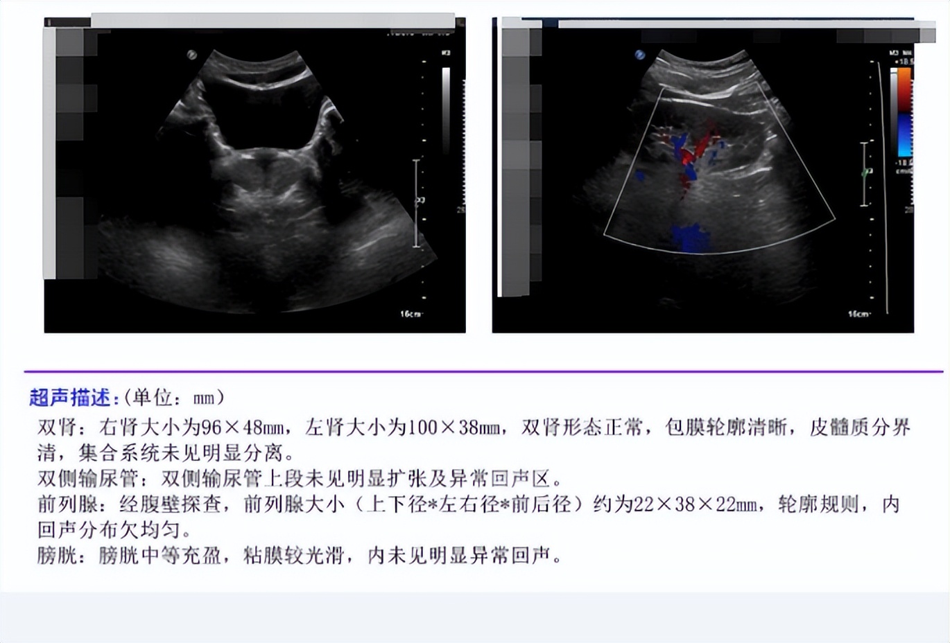 男青年前列腺炎能自愈吗,年轻小伙患前列腺炎能根治吗