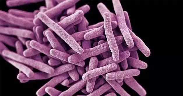 念珠菌真菌感染会引起尿频尿急吗,念珠菌真菌是什么