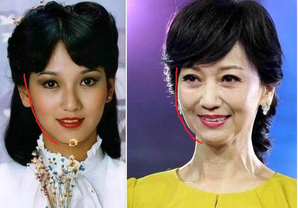 方脸和高颧骨怎么抗老,高颧骨好看还是低颧骨抗老