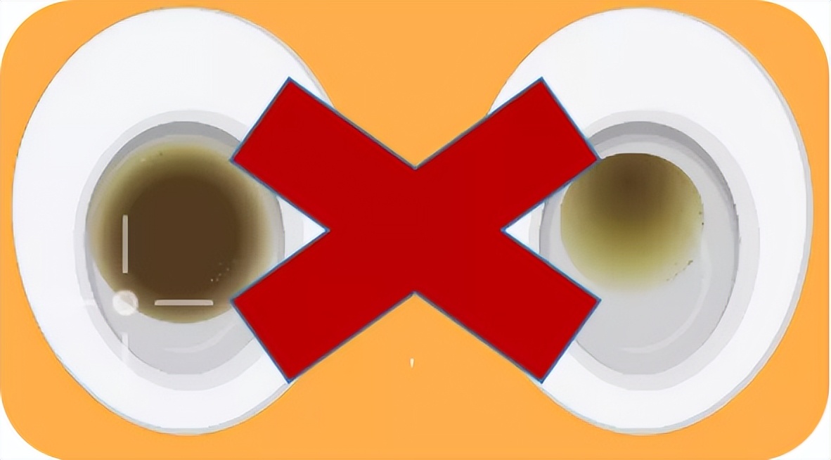 胶囊小肠镜检查前肠道准备,肠道排空十六小时肠镜前准备