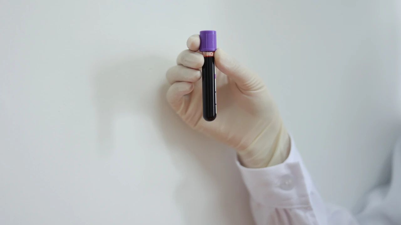 卵巢肿瘤的10个征兆,卵巢肿瘤蒂扭转最常见的症状