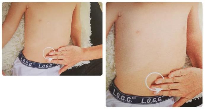 小儿腹泻怎么办？学会推拿让孩子少受罪