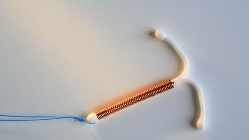 如果节育环过期了再取会怎样取,曼月乐节育环会长进肉里吗