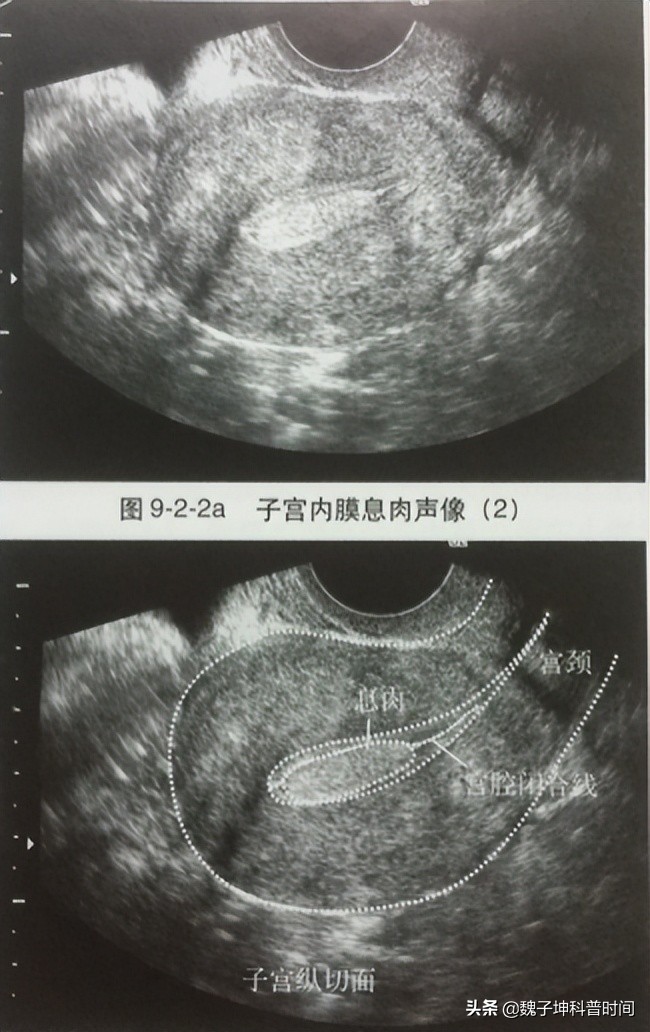 宫腔镜能查到什么,宫腔镜能查到宫颈病变吗