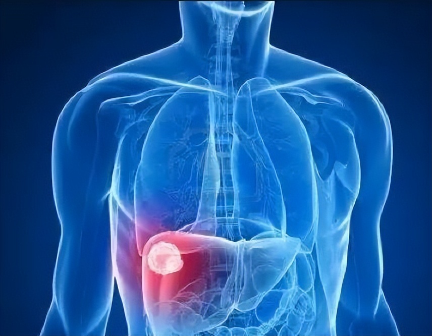 2020年上海交大女博士治癌需80万，丈夫跪地求离婚：求你放我一马