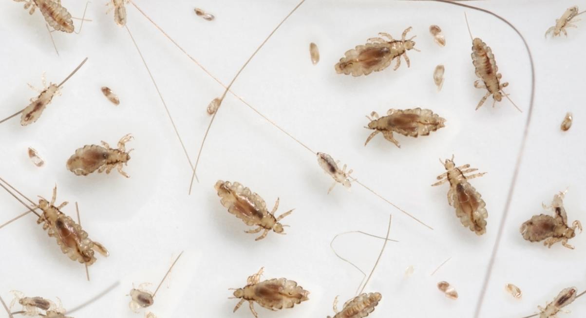 阴虱病怕什么,阴虱可怕吗怎样才能处理干净