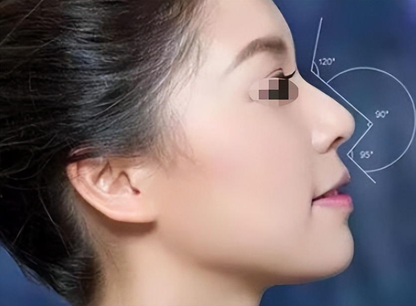 鼻头黑头发红毛孔粗大,怎么判断鼻子上是黑头还是毛孔大