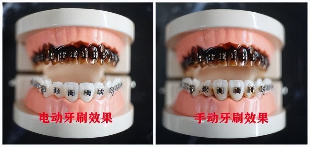 小米电动牙刷和拜尔电动牙刷,小米电动牙刷飞利浦电动牙刷