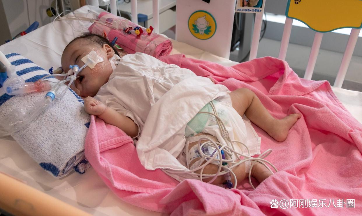 香港女婴心脏移植 (香港首例器官移植)