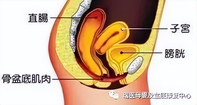 盆底肌松弛，“漏尿”“脱垂”的尴尬，我们帮你解