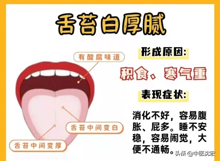 中医教你看舌头得知身体表现,中医看舌头舌苔图谱