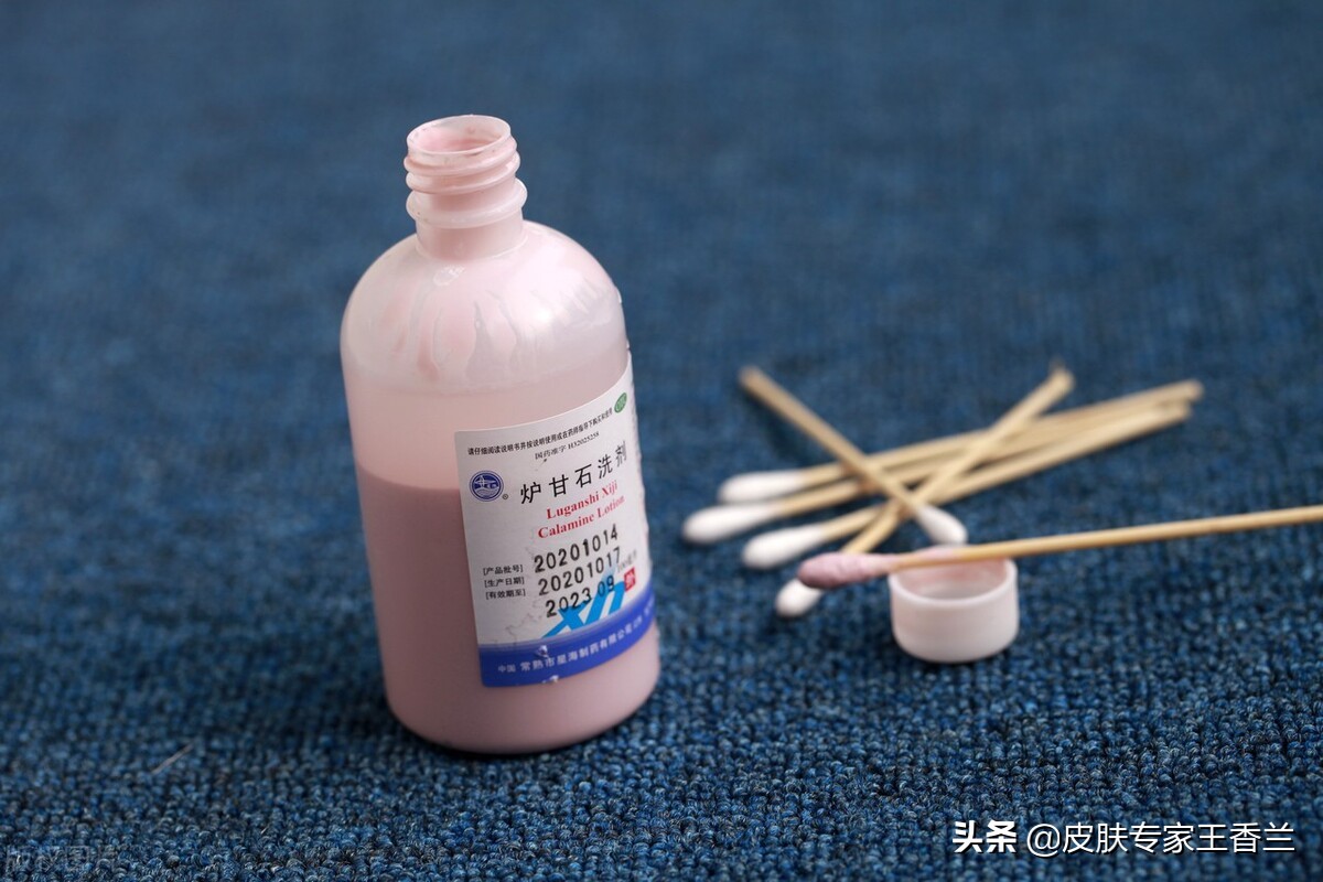 炉甘石洗剂可以用于破损皮肤吗,用完炉甘石洗剂皮肤干燥怎么缓解