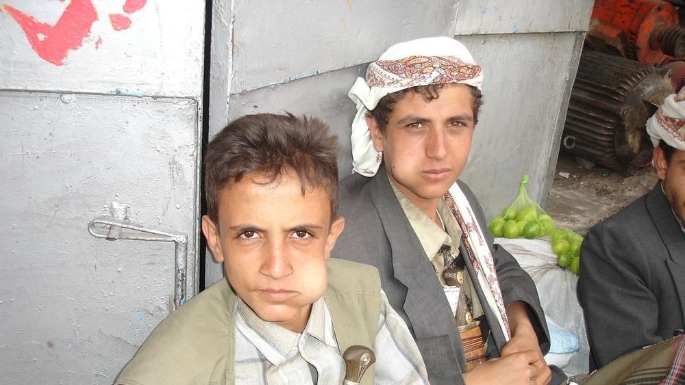 槟榔成瘾的国家,沉迷槟榔应该怎么戒呢