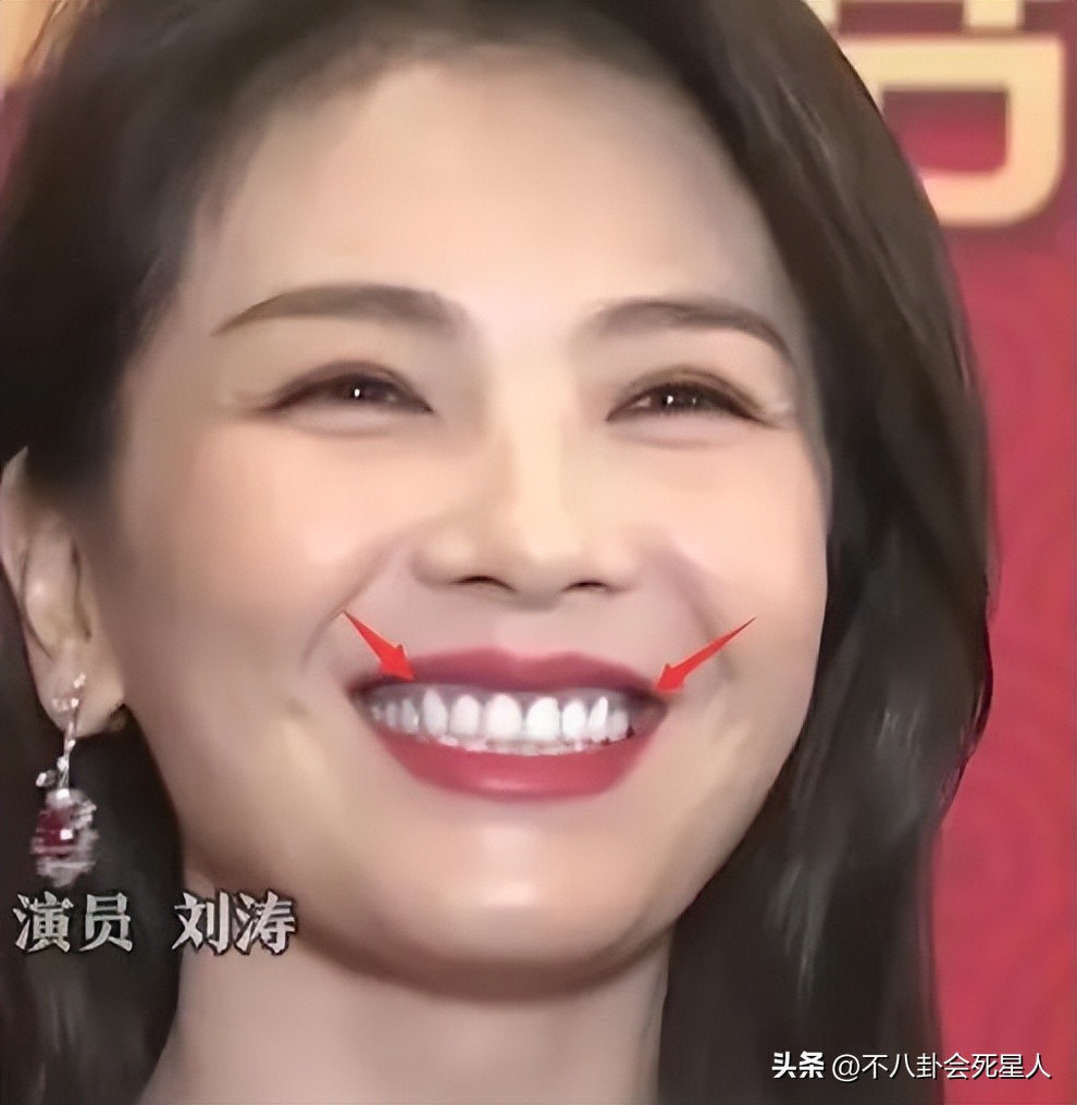 烤瓷牙有多恐怖,烤瓷牙害我一生