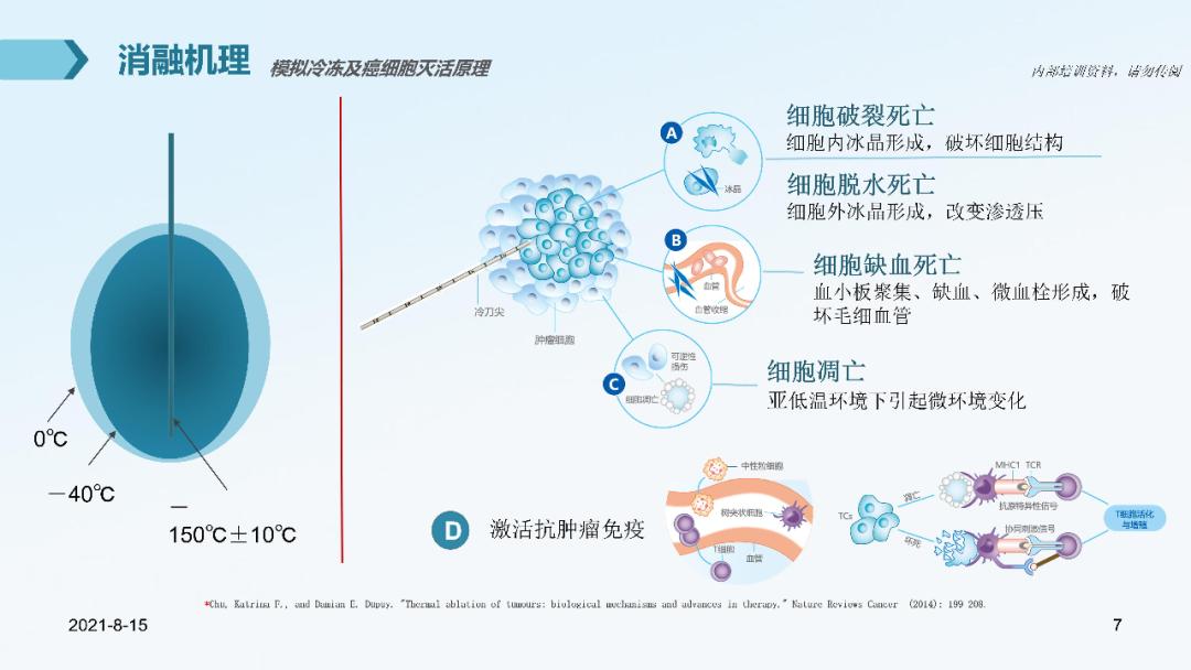 甲状腺结节消融术病例分析,肺部结节冷冻消融