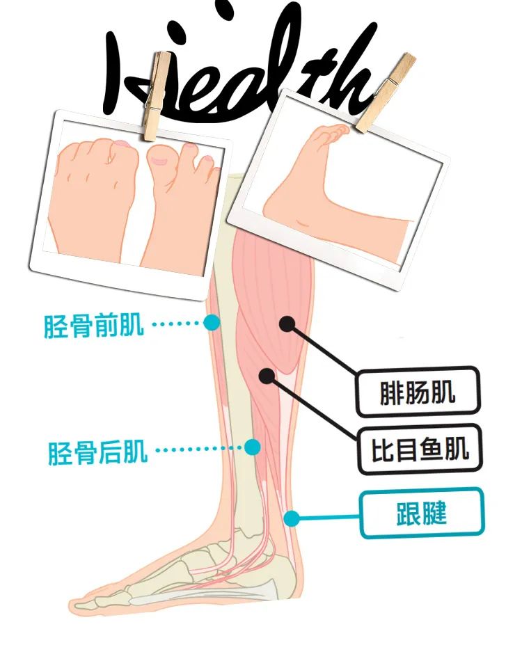 锻炼脚底跟腱的方法有哪些,足部跟腱拉伸的好处