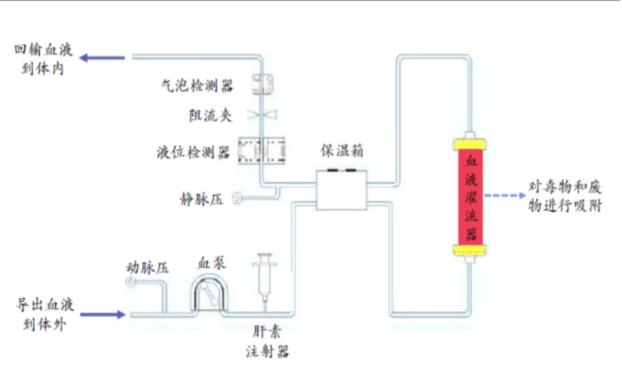 灌流联合性血液净化,血液灌流和血液滤过哪个效果好