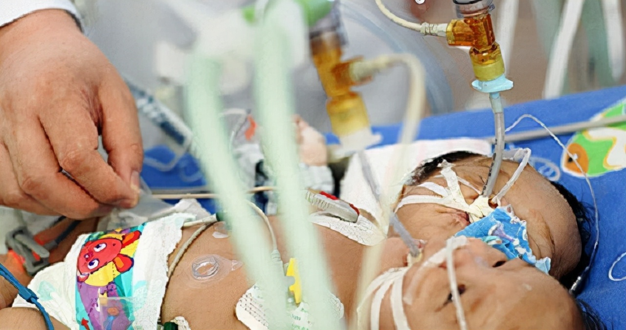 女孩去做体检发现怀了四胞胎,女子怀双胞胎竟是被遗传