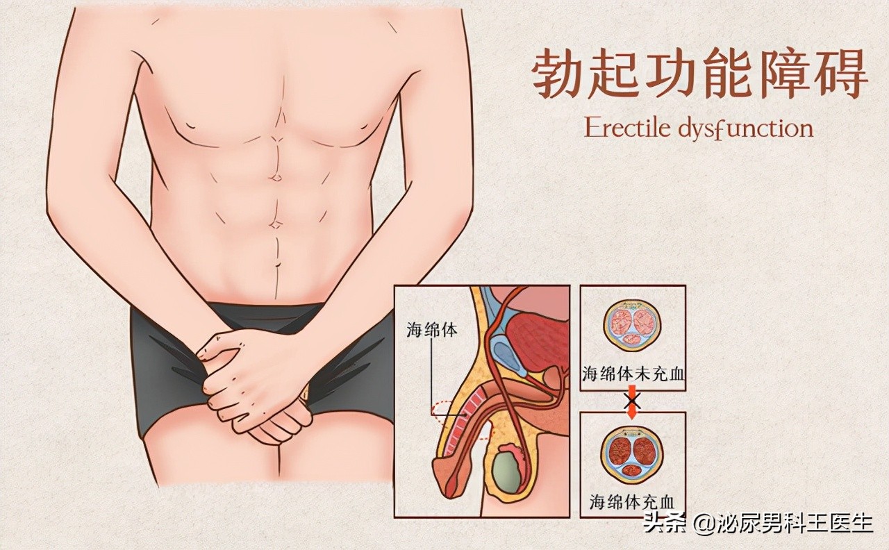 西地那非对中年男性的好处,老年适合西地那非还是伐地那非