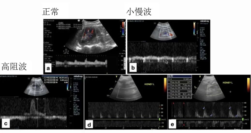 「肾脏病学」刘丽霞教授：肾脏血流动力学监测实施路径