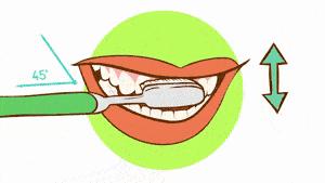 一颗牙齿补牙2600,年纪轻轻补牙补了六颗