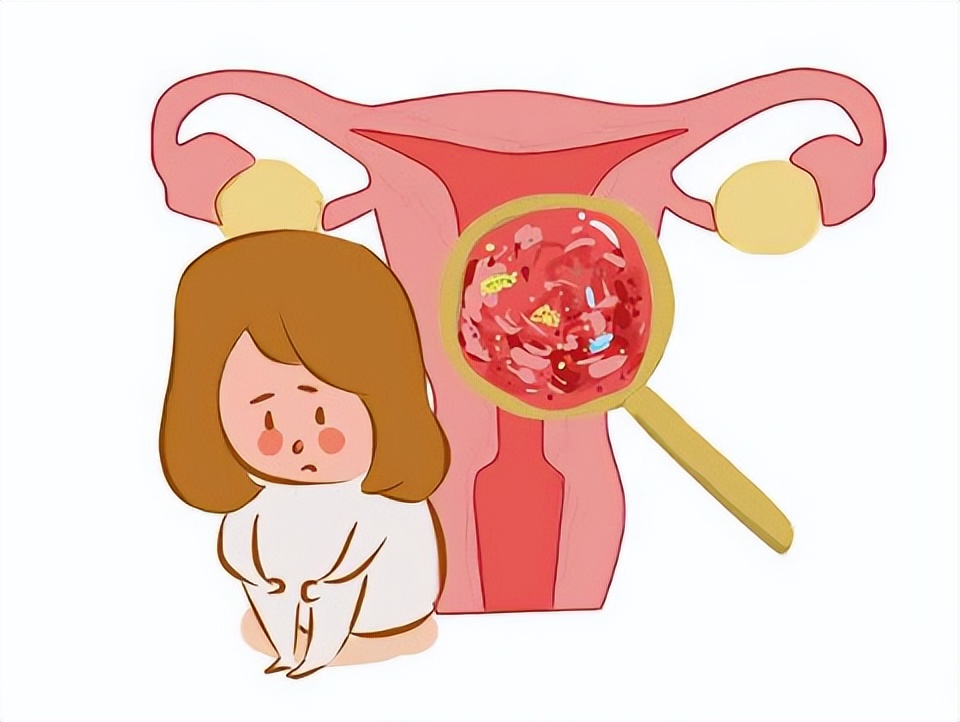 为什么日本女性很少患上妇科病呢？医生：或与3种生活习惯有关