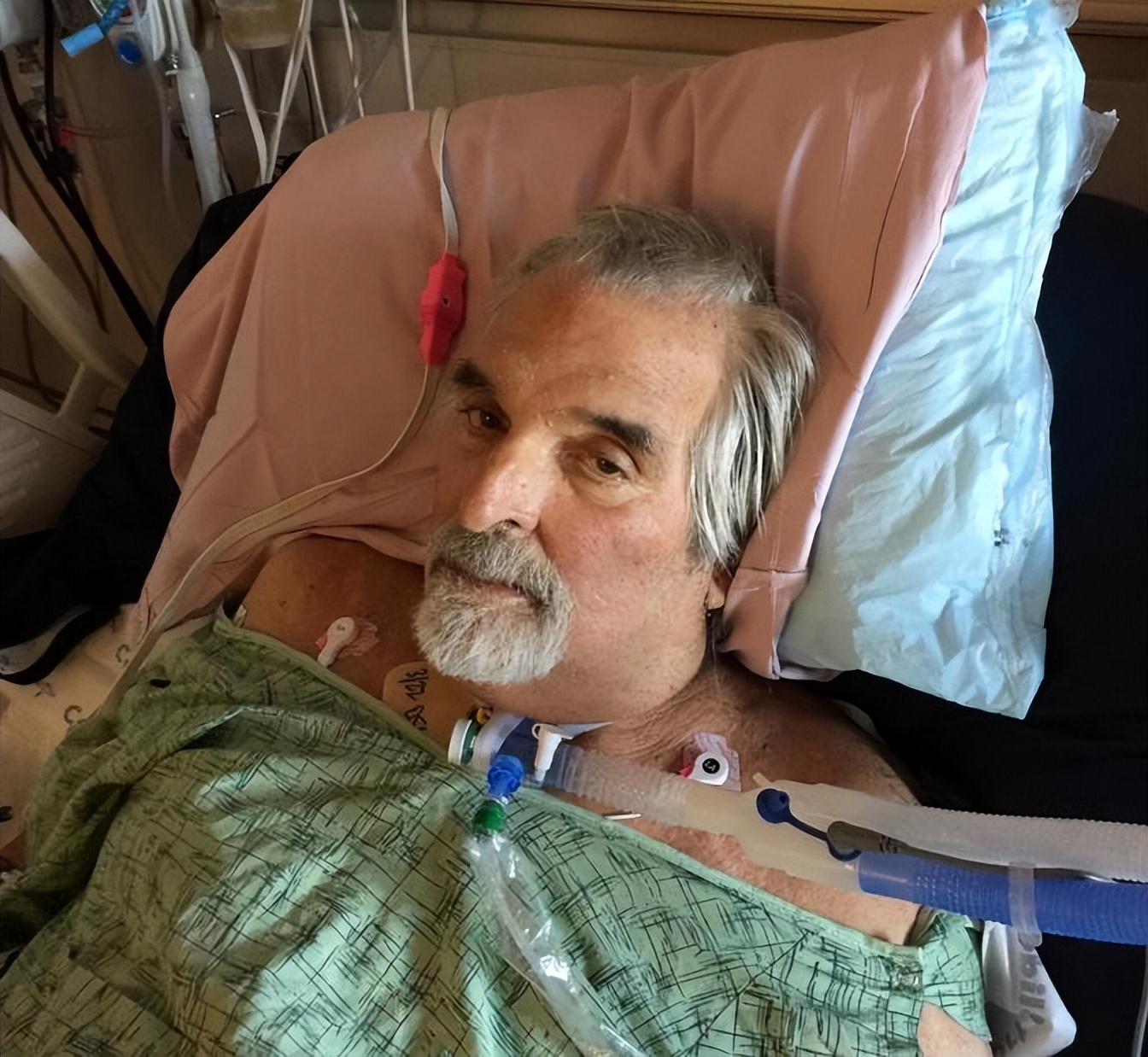 超级细菌病毒自愈案例,男子感染恐怖细菌