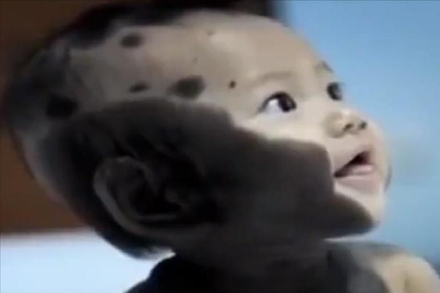 福建孕妇吃老鼠孩子长满黑斑,男子给怀孕的妻子吃竹鼠