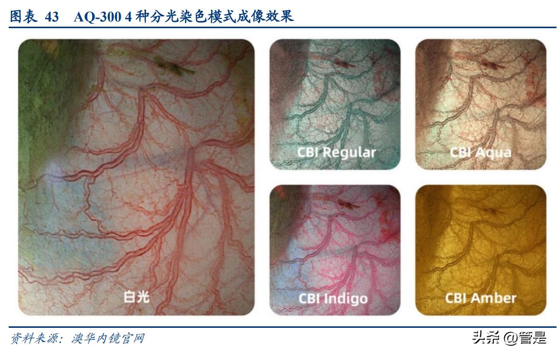 澳华内镜上市价格预测,澳华内镜上市股价预测