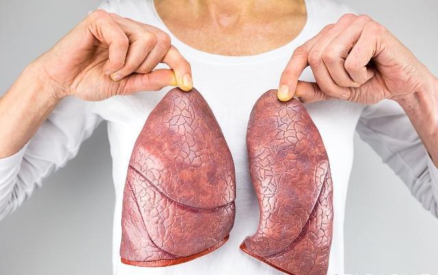 支气管扩张需要做鼻咽镜吗,支气管扩张咯血做支气管镜