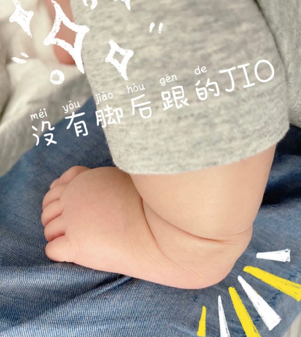 婴儿没后脚跟会怎样,啥意思原来婴儿是没有后脚跟的