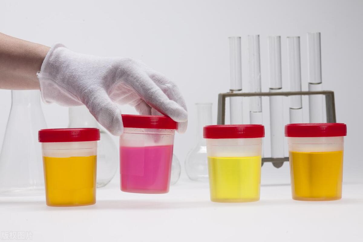 尿常规解析,尿常规检查如何读懂60秒教会你