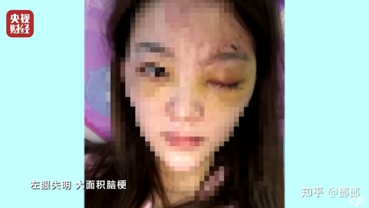 315曝光！美女变大汉、土坑酸菜、医美致脑梗、翡翠直播靠演技