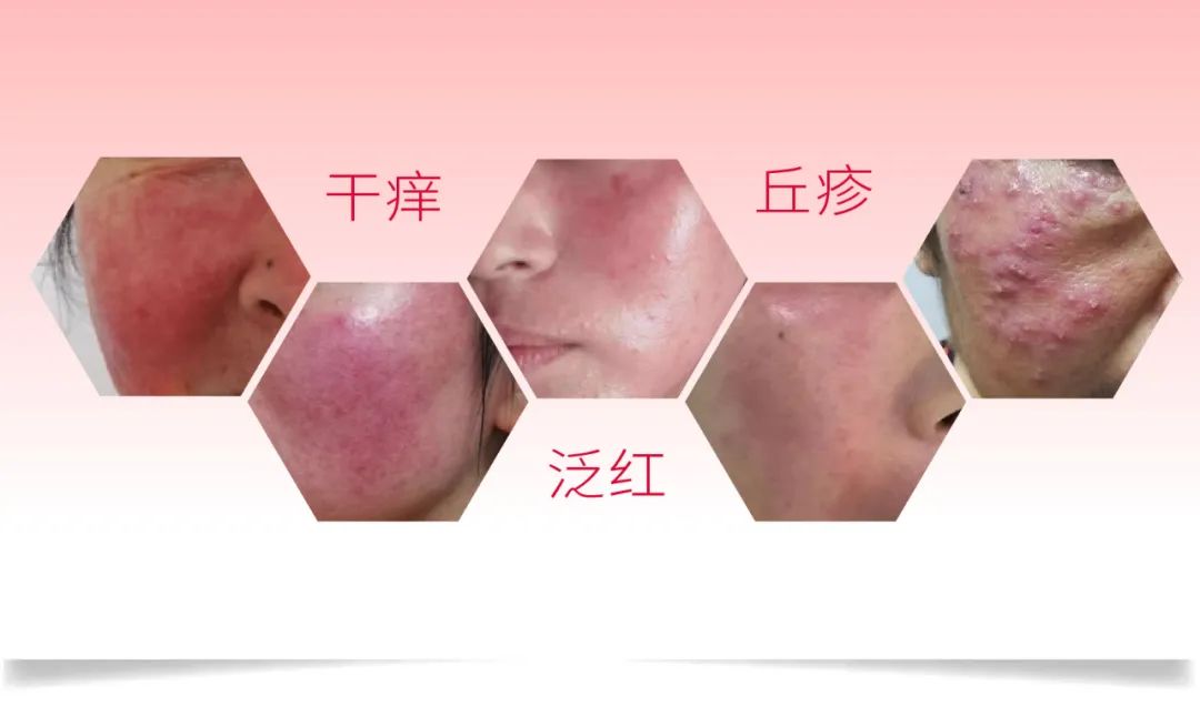 想抗老吃什么好,想抗老又想美白用什么面霜