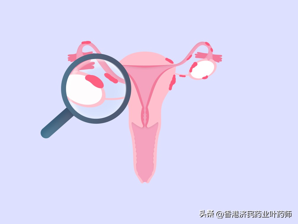 EC批准Ryeqo二型变更申请：用于女性子宫内膜异位症的对症治疗