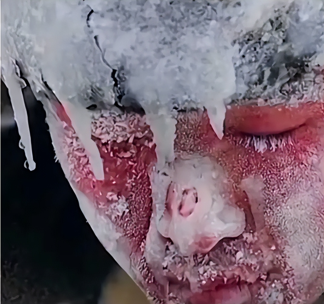 长津湖战役幸存者“朱彦夫”：失去四肢和左眼，今89岁感动中国