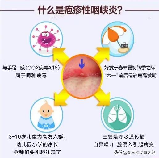 咽峡炎困扰？试试这些中医疗法：安全有效，能让孩子快速恢复健康