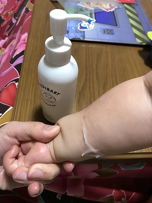 冬季皮肤皲裂,冬季皮肤皲裂怎么办