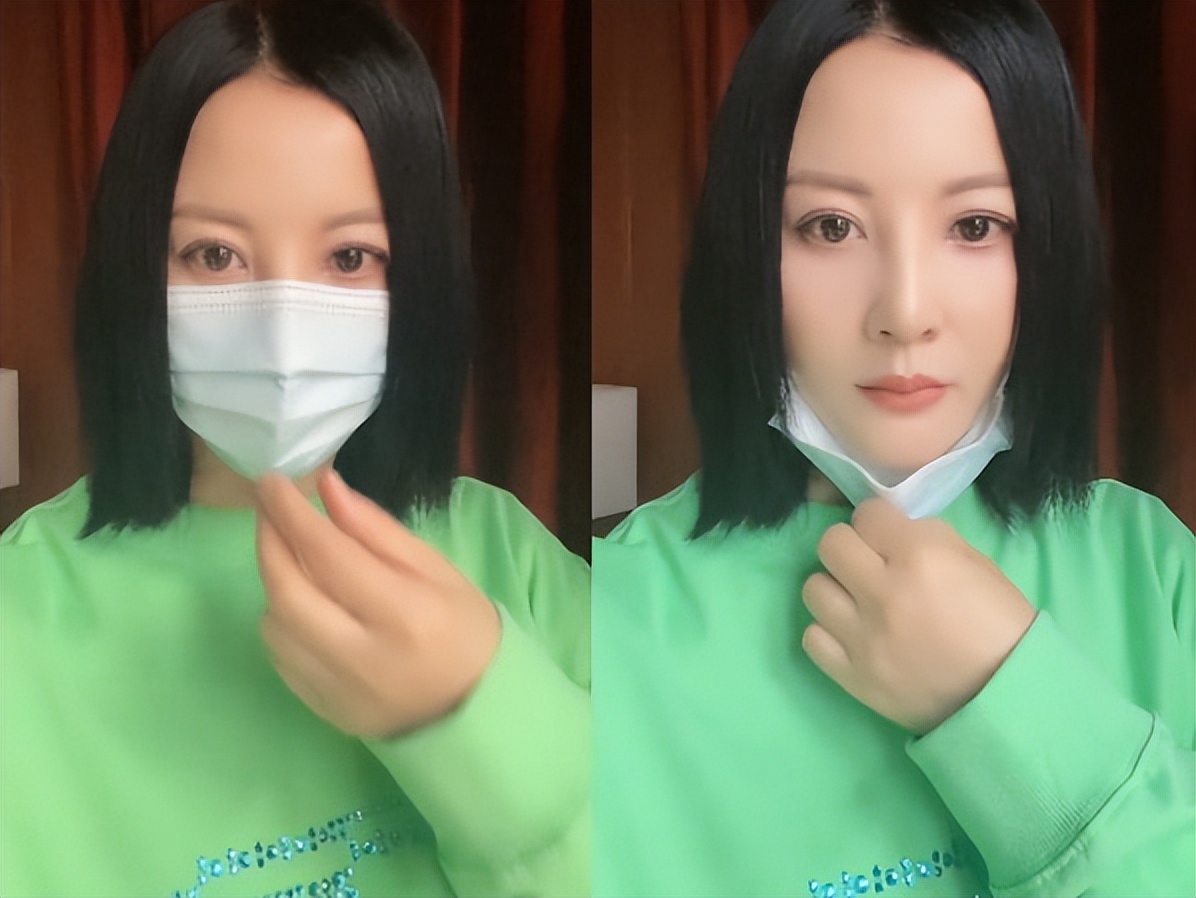 最近脸僵硬的女星,脸部变僵硬的女明星