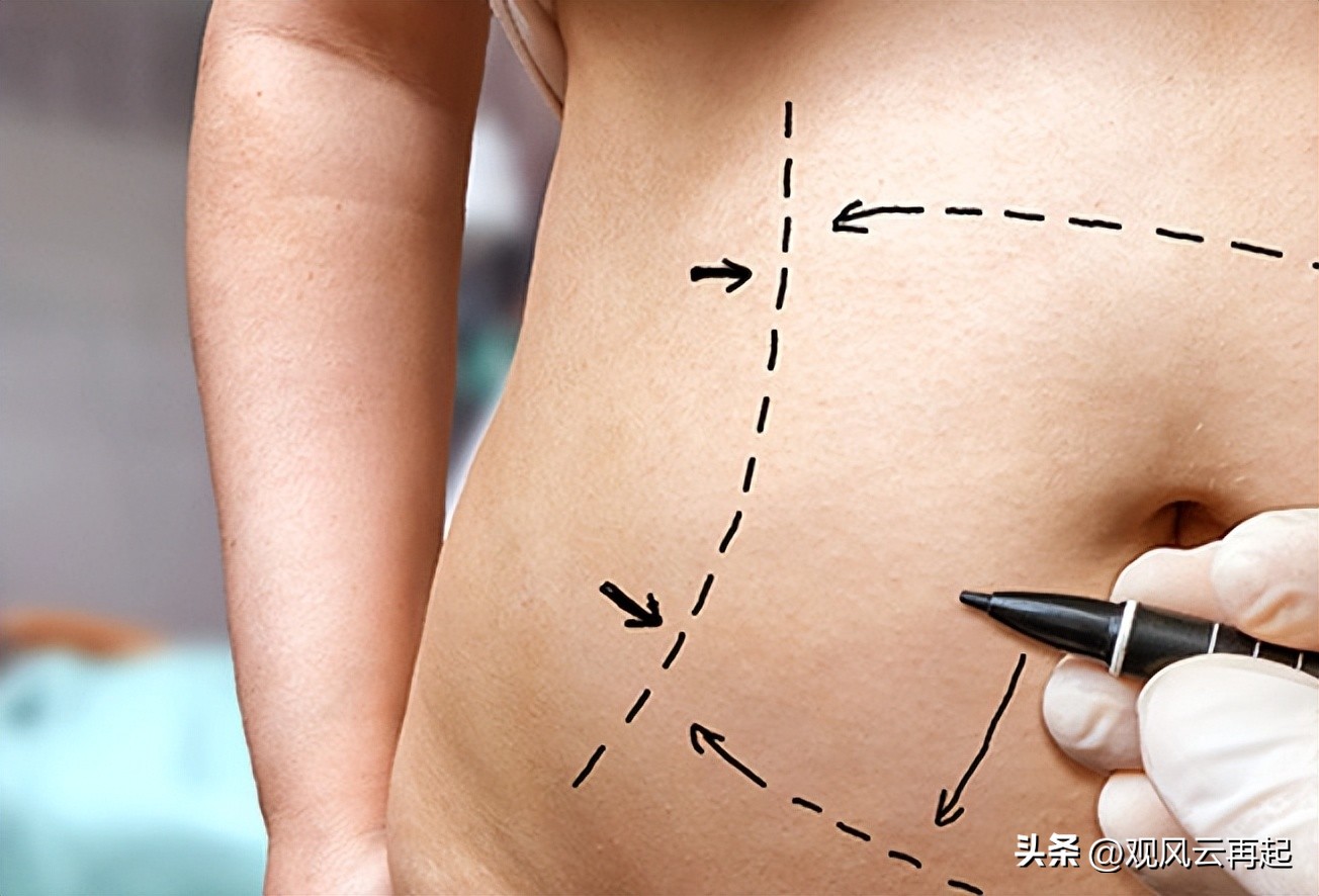 消除大肚子内脏脂肪的最快方法,消耗内脏脂肪最好的方法