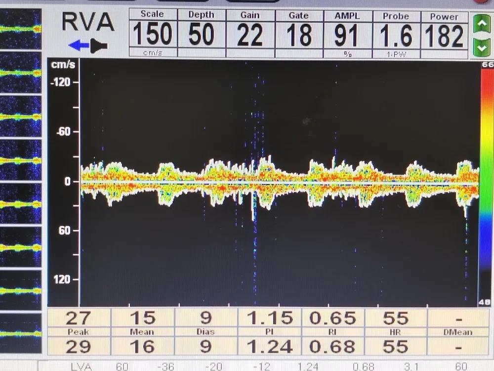 小小竞技支架,小小支撑架