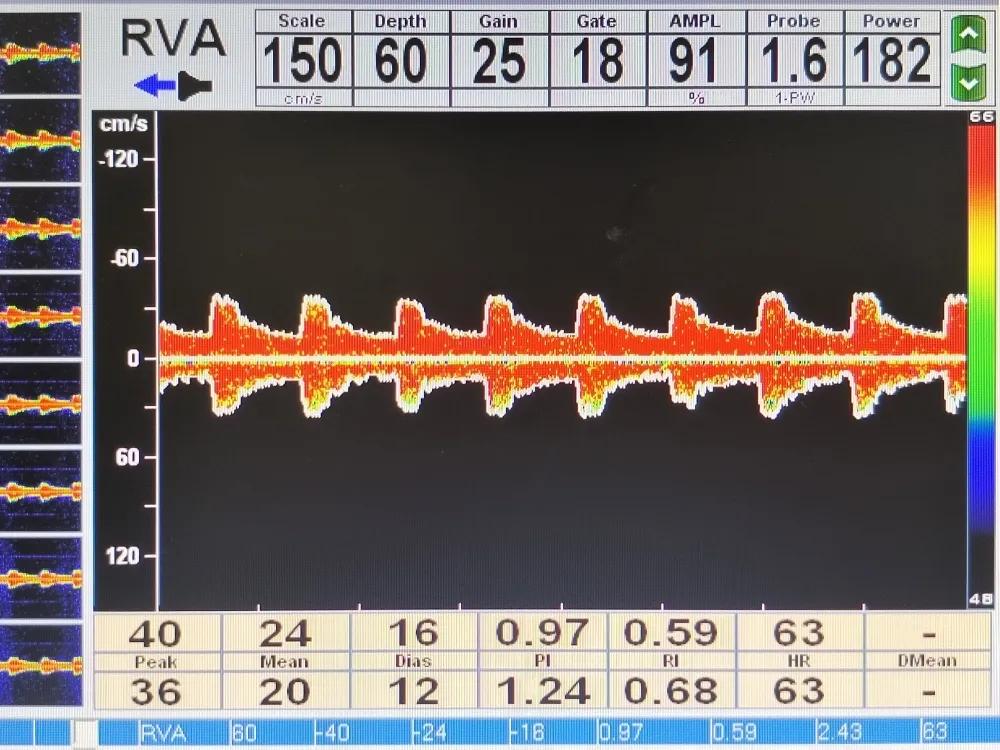 小小竞技支架,小小支撑架