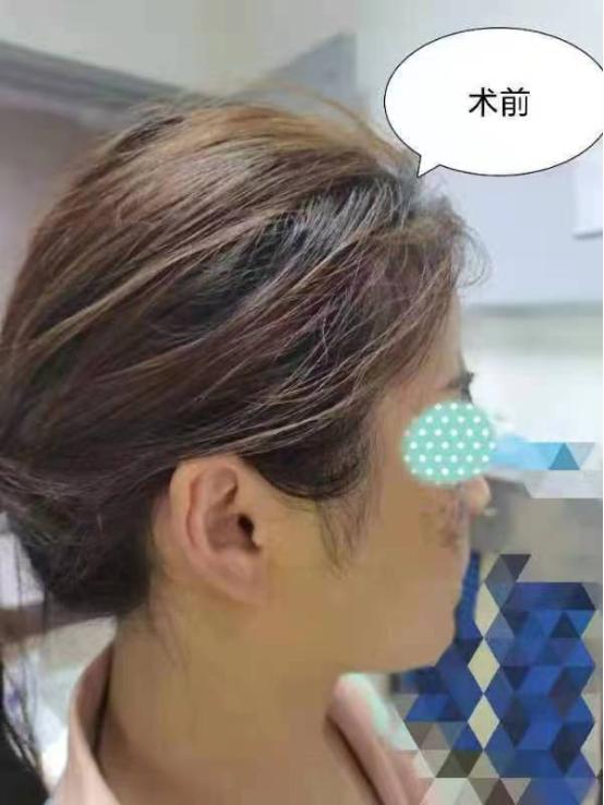 菏泽市立医院口腔科：重塑容颜让美丽依旧